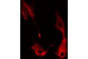 ABIN6274345 staining HeLa cells by IF/ICC. (ITPK1 anticorps  (Internal Region))