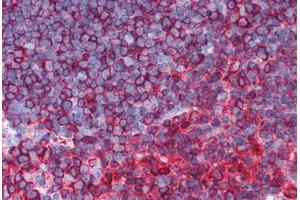 Human Thymus (formalin-fixed, paraffin-embedded) stained with TUBB antibody ABIN305890 at 1:100 followed by biotinylated goat anti-rabbit IgG secondary antibody ABIN481713, alkaline phosphatase-streptavidin and chromogen. (TUBB anticorps  (N-Term) (Alexa Fluor 555))