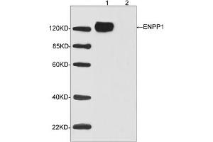 Western blot analysis of transfected HEK293 cell lysates using ENPP1 Antibody (ABIN398962, 1 µg/mL) Loading: Lane 1: Human ENPP1 expression in transfected HEK293 cell lysateLane 2: Non-transfected HEK293 cell lysateSecondary antibody: Donkey Anti-Goat IgG (H&L) [HRP] (ABIN398411, 1: 5,000) Predicted Size: 125 KD Observed Size: 125 KD (ENPP1 anticorps  (C-Term))