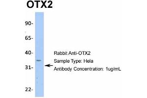 Host:  Rabbit  Target Name:  OTX2  Sample Type:  Hela  Antibody Dilution:  1. (OTX2 anticorps  (N-Term))