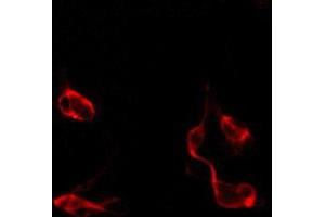 ABIN6274891 staining CoLo by IF/ICC. (DDX54 anticorps  (Internal Region))