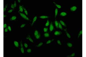 Immunofluorescence staining of Hela cells with ABIN7157190 at 1:100, counter-stained with DAPI.