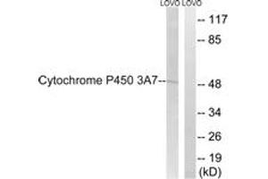 Western blot analysis of extracts from LOVO cells, using Cytochrome P450 3A7 Antibody. (CYP3A7 anticorps  (AA 231-280))