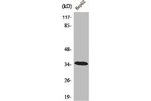 Western Blot analysis of HepG2 cells using CA XIII Polyclonal Antibody (CA13 anticorps  (Internal Region))