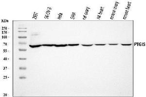 Western blot analysis of PTGIS/PGIS using anti-PTGIS/PGIS antibody (ABIN7599806).