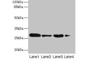 Western blot All lanes: MED7 antibody at 6 μg/mL Lane 1: Jurkat whole cell lysate Lane 2: Hela whole cell lysate Lane 3: Mouse thymus tissue Lane 4: NIH/3T3 whole cell lysate Secondary Goat polyclonal to rabbit IgG at 1/10000 dilution Predicted band size: 28 kDa Observed band size: 28 kDa (MED7 anticorps  (AA 1-233))