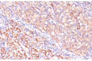 Immunohistochemistry of paraffin-embedded Rat ovary using VHL Polyclonal Antibody at dilution of 1:200 (40x lens). (VHL anticorps)