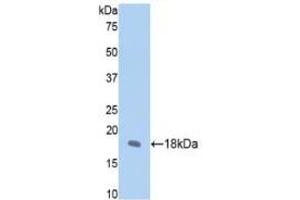 Detection of Recombinant FBN1, Rat using Polyclonal Antibody to Fibrillin 1 (FBN1)