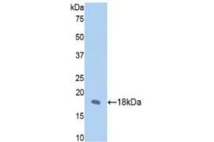 Detection of Recombinant FBN1, Rat using Polyclonal Antibody to Fibrillin 1 (FBN1) (Fibrillin 1 anticorps  (AA 751-895))