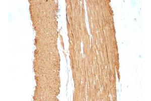 Formalin-fixed, paraffin-embedded Rat Stomach stained with Smooth Muscle Actin Monoclonal Antibody (1A4 + ACTA2/791).