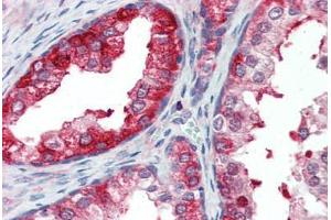 Anti-SKP2 antibody IHC staining of human prostate.