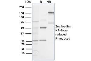SDS-PAGE Analysis Purified Spastin Mouse Monoclonal Antibody (Sp 6C6). (Spastin anticorps)