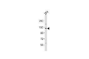 Anti-stk10 Antibody (Center)at 1:2000 dilution + ZF4 whole cell lysates Lysates/proteins at 20 μg per lane. (STK10-A anticorps  (AA 342-376))