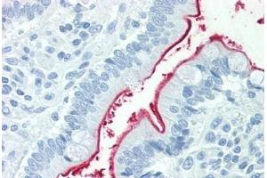 Human Small Intestine: Formalin-Fixed, Paraffin-Embedded (FFPE) (NPC1L1 anticorps  (Internal Region))