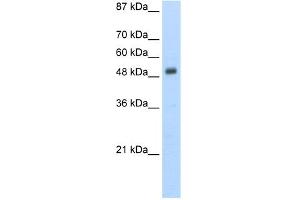 WB Suggested Anti-DES Antibody Titration:  5. (Desmin anticorps  (N-Term))