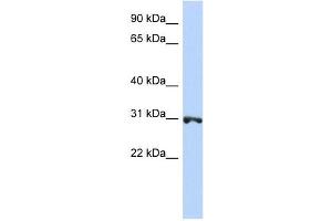 RNF126 antibody used at 1 ug/ml to detect target protein. (RNF126 anticorps  (N-Term))