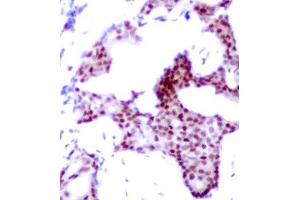 Immunohistochemistry (IHC) image for anti-Nuclear Factor-kB p65 (NFkBP65) (pSer276) antibody (ABIN1682005)