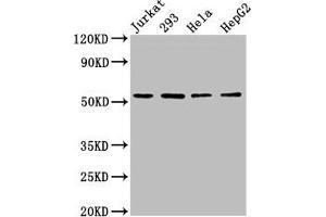 Western Blot Positive WB detected in: Jurkat whole cell lysate, 293 whole cell lysate, Hela whole cell lysate, HepG2 whole cell lysate All lanes: SLC16A12 antibody at 3 μg/mL Secondary Goat polyclonal to rabbit IgG at 1/50000 dilution Predicted band size: 54 kDa Observed band size: 54 kDa