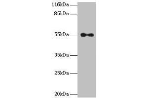 Western blot All lanes: THRA antibody at 2 μg/mL + A431 whole cell lysate Secondary Goat polyclonal to rabbit IgG at 1/10000 dilution Predicted band size: 55, 47, 51 kDa Observed band size: 55 kDa (THRA anticorps  (AA 1-490))