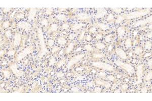 Detection of TRPM7 in Rat Kidney Tissue using Polyclonal Antibody to Transient Receptor Potential Cation Channel Subfamily M, Member 7 (TRPM7)