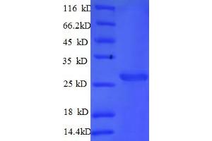 SDS-PAGE (SDS) image for Cathepsin S (CTSS) (AA 123-340) protein (His tag) (ABIN5709371)