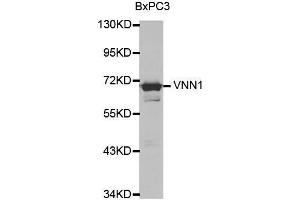 Western blot analysis of extracts of various cell lines, using VNN1 antibody. (VNN1 anticorps  (AA 300-415))
