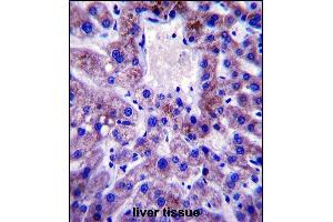 UBE2W Antibody (C-term) (ABIN657530 and ABIN2846549) immunohistochemistry analysis in formalin fixed and paraffin embedded human liver tissue followed by peroxidase conjugation of the secondary antibody and DAB staining. (UBE2W anticorps  (C-Term))