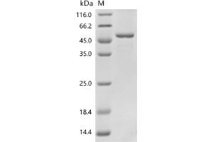 (Tris-Glycine gel) Discontinuous SDS-PAGE (reduced) with 5 % enrichment gel and 15 % separation gel.