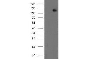 Western Blotting (WB) image for anti-Excision Repair Cross-Complementing Rodent Repair Deficiency, Complementation Group 4 (ERCC4) antibody (ABIN1498070) (ERCC4 anticorps)
