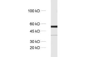 dilution: 1 : 1000, sample: rat brain homogenate (TUBB3 anticorps)