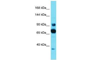 Host: Rabbit Target Name: CCDC178 Sample Type: HT1080 Whole Cell lysates Antibody Dilution: 1. (CCDC178 anticorps  (C-Term))