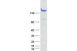 Validation with Western Blot