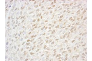 Immunohistochemistry (IHC) image for anti-SSB1 (AA 161-211) antibody (ABIN7448816) (SSB1 (AA 161-211) anticorps)