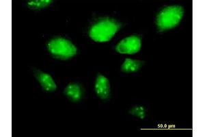 Immunofluorescence of purified MaxPab antibody to HSPA2 on HeLa cell. (HSPA2 anticorps  (AA 1-639))