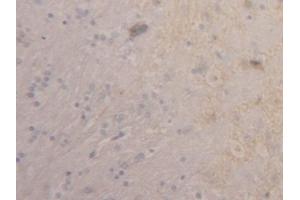Detection of TM in Rat Cerebrum Tissue using Polyclonal Antibody to Thrombomodulin (TM)