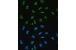 Immunofluorescence analysis of U-2 OS cells using MKL1 Polyclonal Antibody  at dilution of 1:100 (40x lens). (MKL1 anticorps  (AA 1-280))