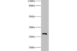 Western blot All lanes: HSD17B14 antibody at 2 μg/mL + Mouse kidney tissue Secondary Goat polyclonal to rabbit IgG at 1/10000 dilution Predicted band size: 29 kDa Observed band size: 29 kDa (HSD17B14 anticorps  (AA 1-270))