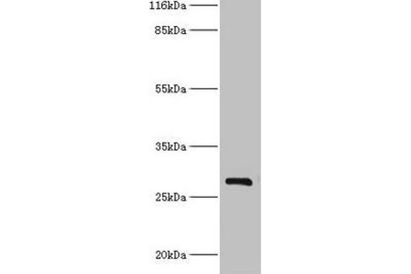 HSD17B14 anticorps  (AA 1-270)