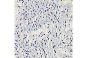 Immunohistochemistry of paraffin-embedded mouse uterus using Progesterone Receptor Rabbit pAb (ABIN6128570, ABIN6145518, ABIN6145519 and ABIN6213802) at dilution of 1:100 (40x lens). (Progesterone Receptor anticorps  (AA 1-250))