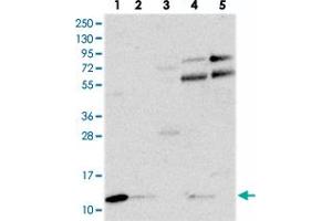 Western blot analysis of Lane 1: RT-4, Lane 2: U-251 MG, Lane 3: Human Plasma, Lane 4: Liver, Lane 5: Tonsil with C18orf32 polyclonal antibody  at 1:250-1:500 dilution. (C18orf32 anticorps)