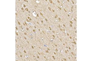 Immunohistochemistry of paraffin-embedded rat brain using SOCS1 Rabbit pAb (ABIN6128737, ABIN6148263, ABIN6148266 and ABIN6223700) at dilution of 1:250 (40x lens). (SOCS1 anticorps  (AA 1-211))