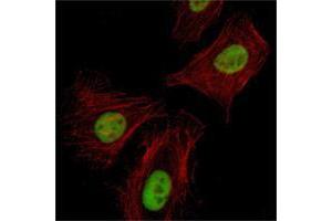 Immunofluorescence analysis of Hela cells using Pirh2 mouse mAb (green). (RCHY1 anticorps)