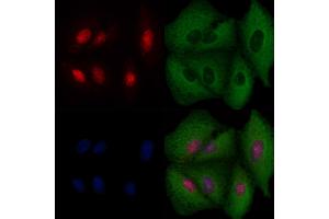 ABIN6256973 and ABIN6274518 staining  cells by IF/ICC. (BRMS1 anticorps  (N-Term))