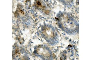 IHC analysis of ANPEP using anti-ANPEP antibody (ABIN7600087). (CD13 anticorps  (AA 148-966))