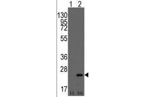 Western blot analysis of BarX1(arrow) using rabbit polyclonal BarX1 Antibody (C-term) . (BARX1 anticorps  (Middle Region))