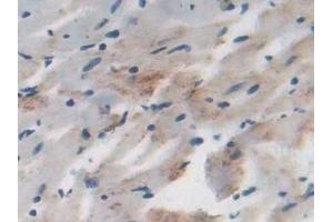 Detection of DLD in Rat Heart Tissue using Polyclonal Antibody to Dihydrolipoyl Dehydrogenase (DLD) (DLD anticorps)