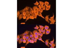 Immunofluorescence analysis of HeLa cells using RPL23 antibody (ABIN1682575, ABIN5664722, ABIN5664724 and ABIN6220574) at dilution of 1:100. (RPL23 anticorps  (AA 1-140))
