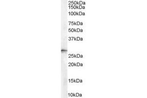 Image no. 2 for anti-Stratifin (SFN) (Internal Region), (N-Term) antibody (ABIN374638) (14-3-3 sigma/SFN anticorps  (Internal Region, N-Term))