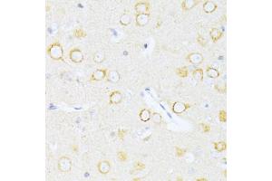 Immunohistochemistry of paraffin-embedded rat brain using Casp8 antibody (ABIN5997368) at dilution of 1/100 (40x lens). (Caspase 8 anticorps)