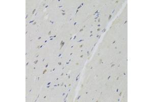 Immunohistochemistry of paraffin-embedded mouse heart using DOK1 Antibody (ABIN6130881, ABIN6139763, ABIN6139764 and ABIN6221343) at dilution of 1:100 (40x lens).